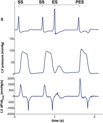 An Augmented Negative Force-Frequency Relationship and Slowed Mechanical Restitution Are Associated With Increased Susceptibility to Drug-Induced Torsade de Pointes Arrhythmias in the Chronic Atrioventricular Block Dog